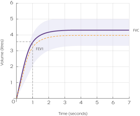 a-visual-volume-time-graph