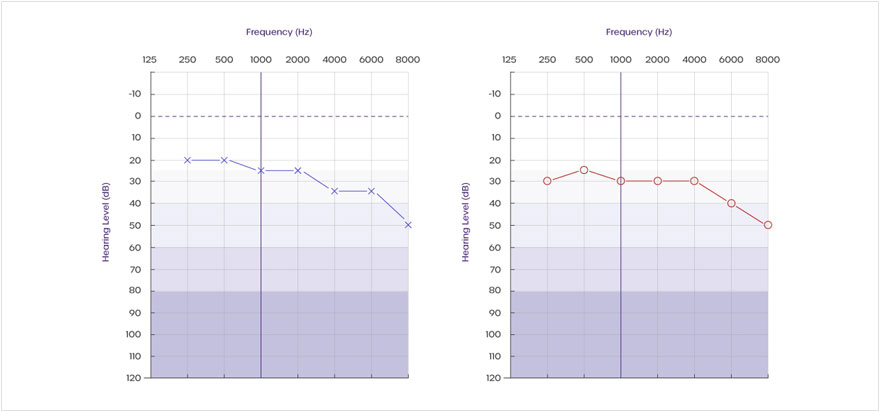 audiogram-test-results