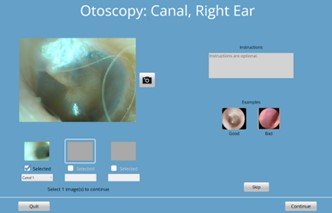 right-ear-otoscopy