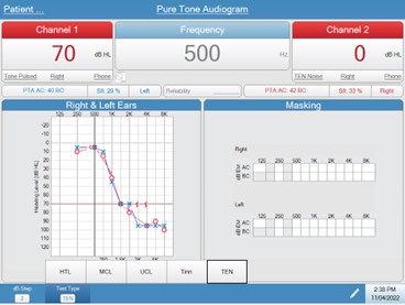 audiostar-pro-ten-test