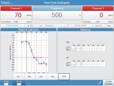 audiostar-pro-ten-test
