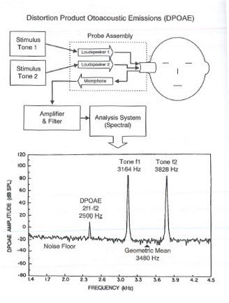 DPOAE Testing Overview