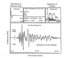 TEOAE Testing Overview
