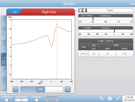 Resonant frequency tympanogram