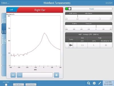 WideBand average tympanometry