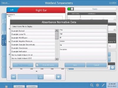WideBand examples tracing dialog box
