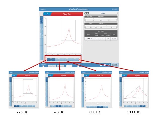 The four single frequency tympanograms from WideBand testing