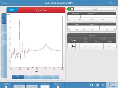 WideBand Tympanometry noise example