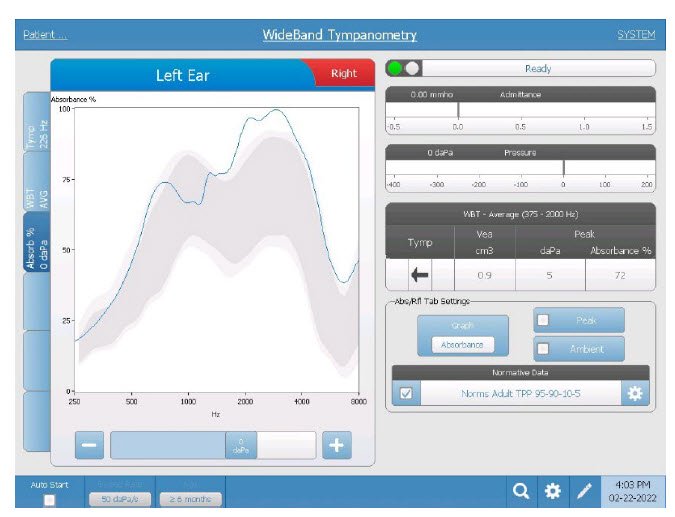 wideband-tympanometry-absorbance-graph