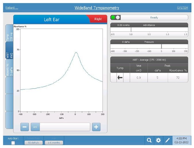 wideband-tympanometry-screen