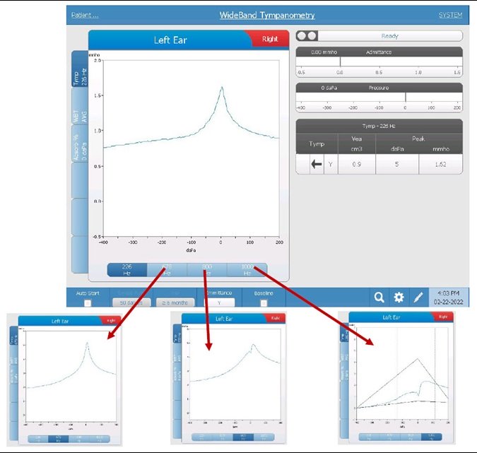 wideband-tympanometry-tabs