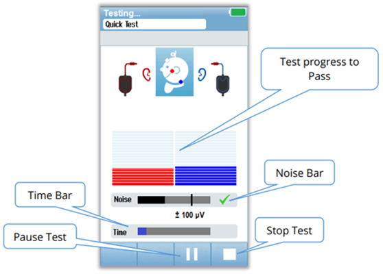 aabr-novus-quick-test-screen