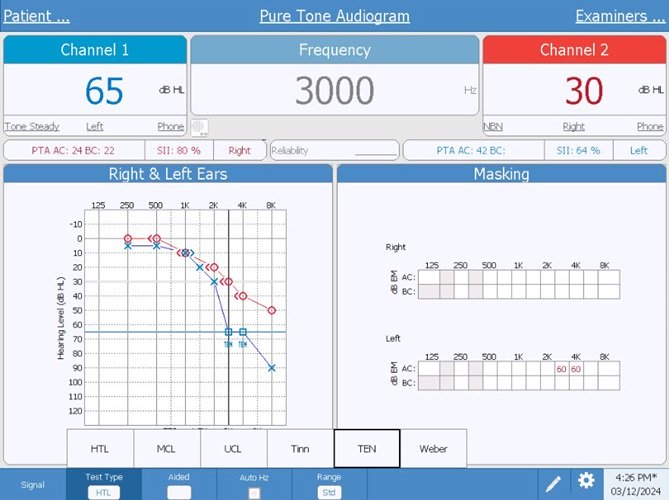ten-test-audiometry-screen