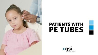 Corti Patients with PE Tubes Video