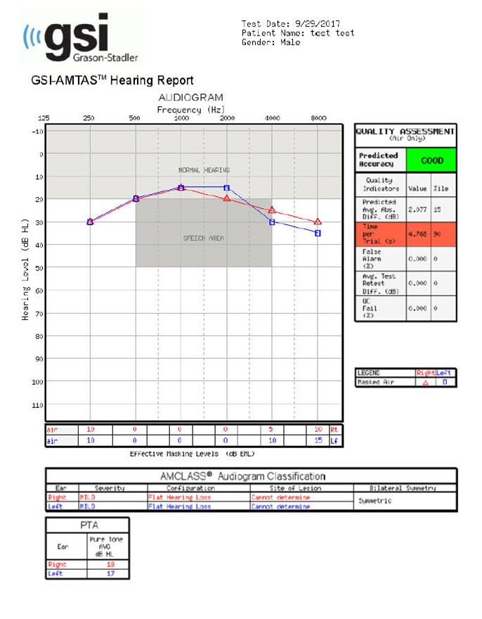 An audiogram generated from AMTAS Flex tablet audiometer