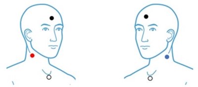 cVEMP Electrode Placement Left and Right