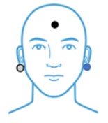 ECochG Left Ear Electrode Placement