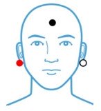 ECochG Right Ear Electrode Placment