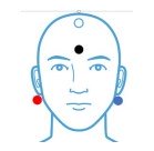 MLR Electrode Placement