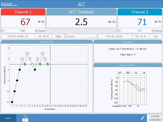audiostar-pro-act-test-screen-with-data