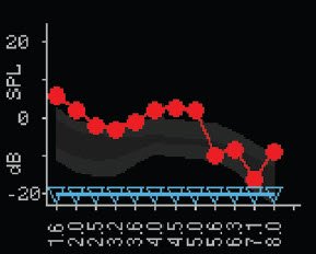 DPOAE Testing Screen