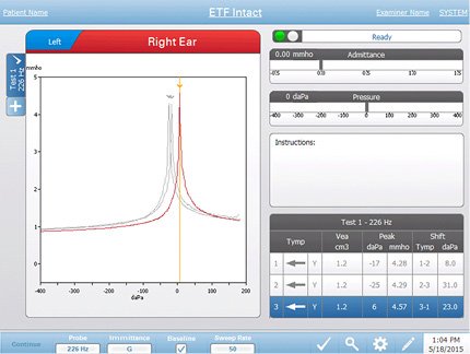 Eustachian tube function testing screen