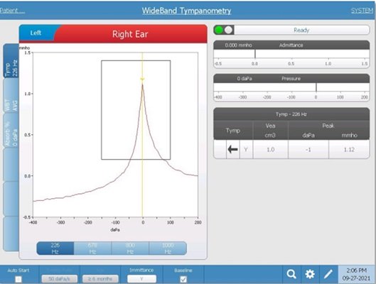 wideband-tympanometry-screen