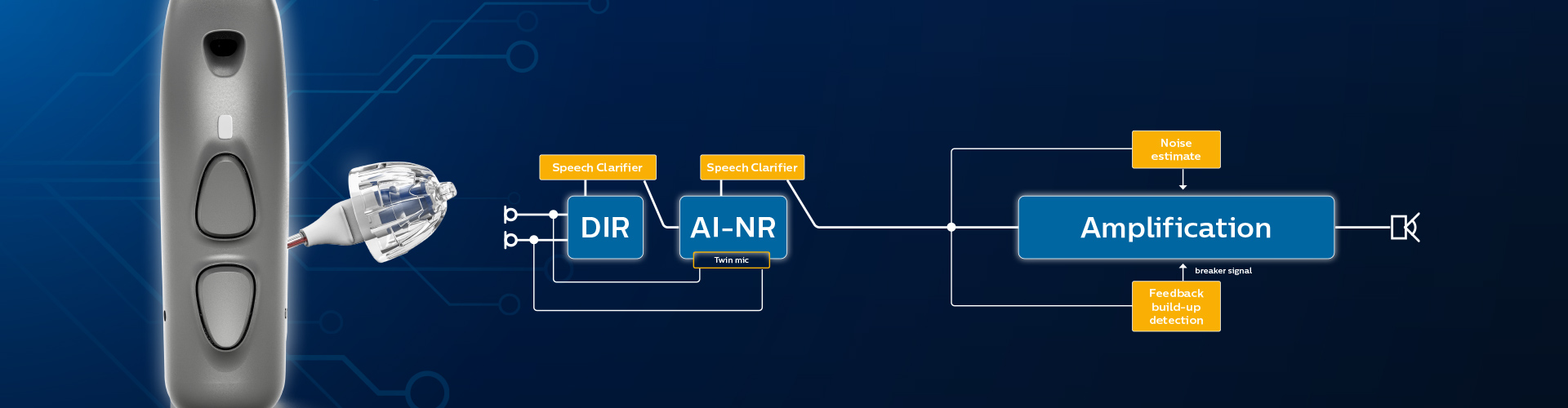 The architecture of SoundMap 2 technology – Philips HearLink hearing aids with AI sound technology.