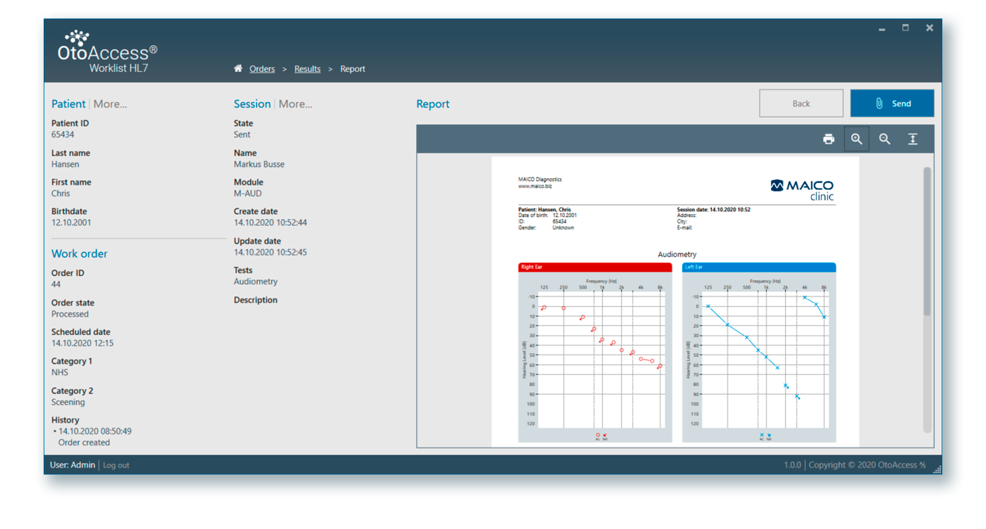 OtoAccess Worklist HL7 Screenshot
