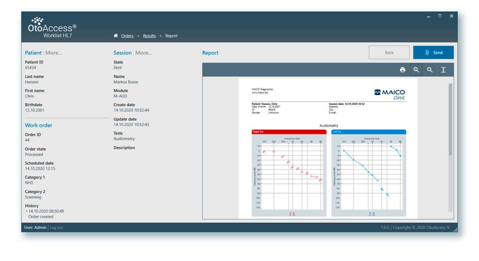 OtoAccess Worklist HL7 Screenshot