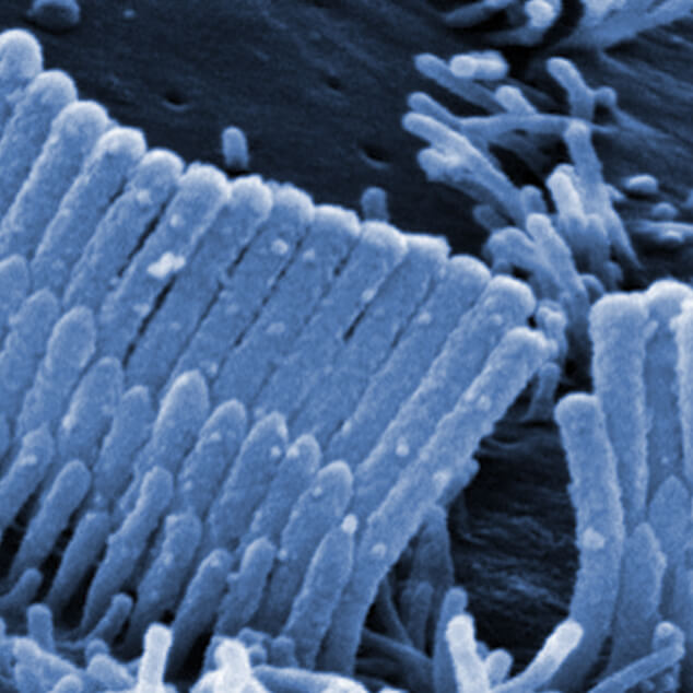 ipoacusia-maico-image-spot-1