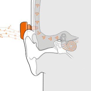 310x310-activation-ponto
