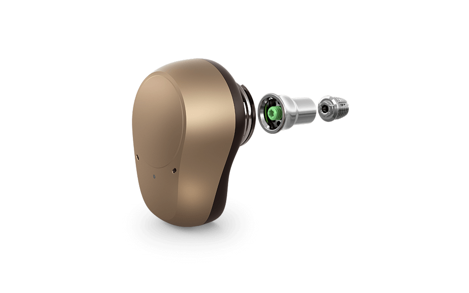 Ponto 4 - what is bone conduction hearing