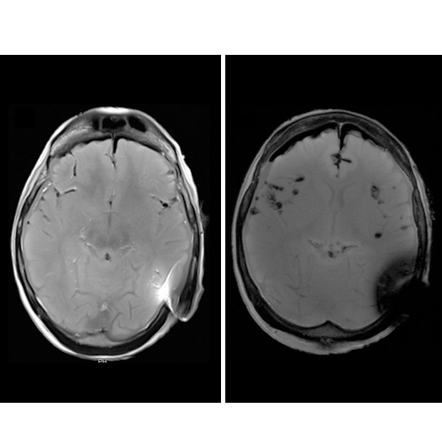 620x620-mri-f2