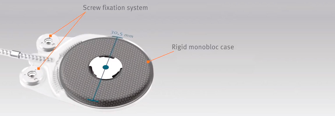 1150x400-how-to-postion-the-implant