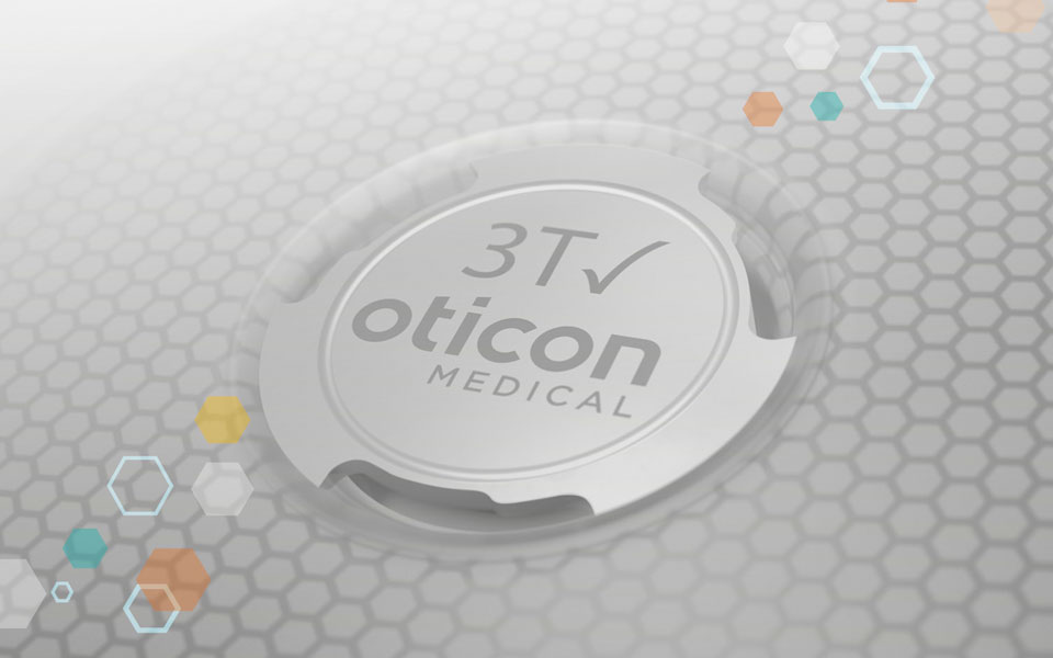 960x600-3t-made-for-mri-scans-at-3-tesla