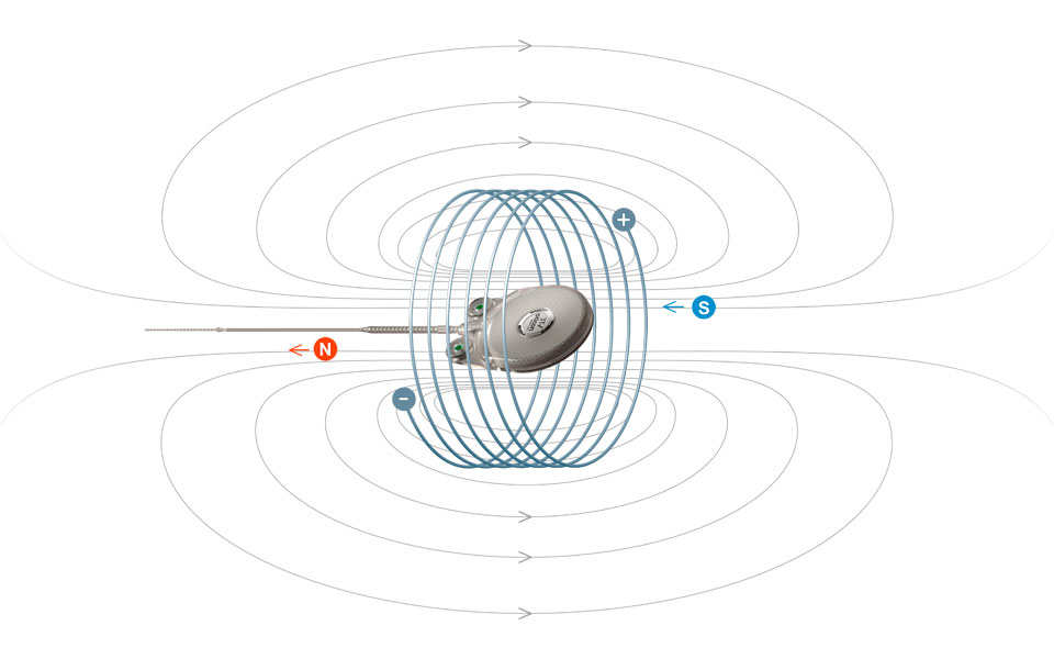 960x600-3t-design-excellence-in-the-implant-magnet