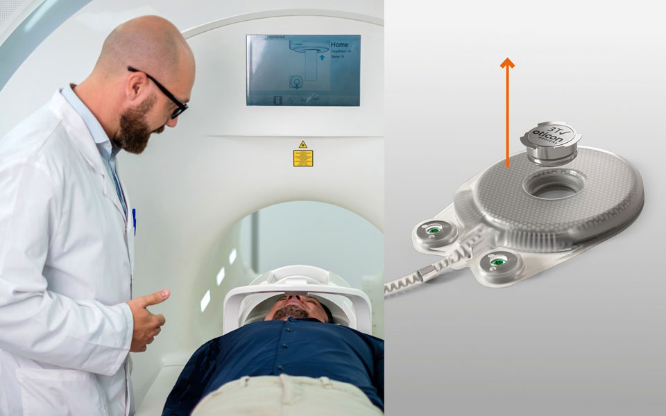 960x600-magnet-removal-is-easy