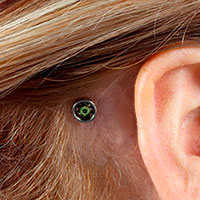 200x200-healing-process