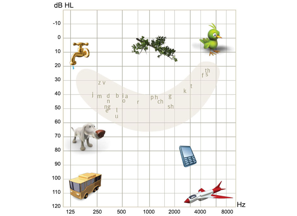 960x700-audiogram-speechbanana