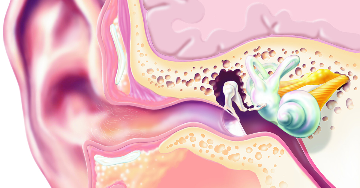 1200x628_ohr