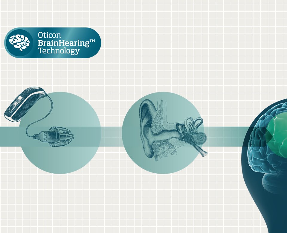 Schéma représentant le brainhearing
