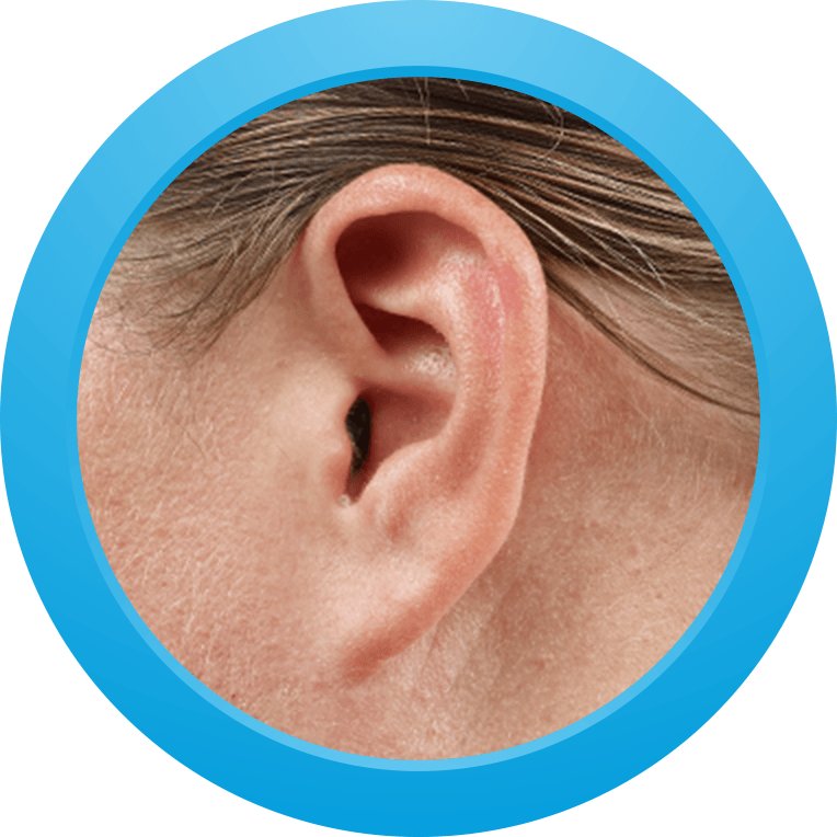 Custom hearing aid in action