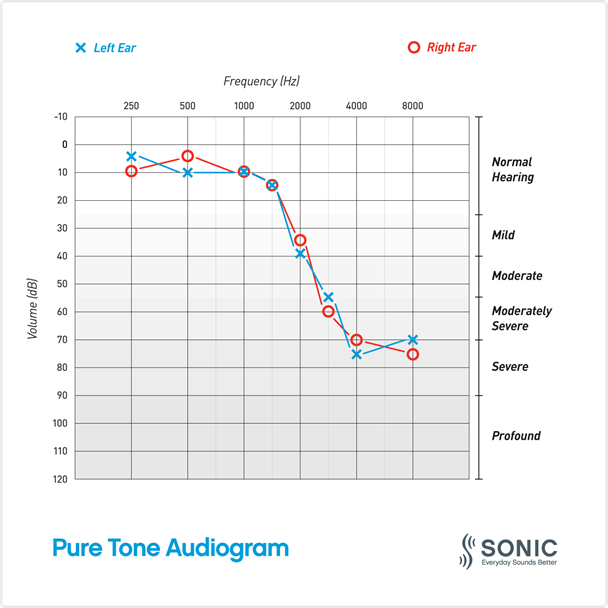000-blog-inline-images