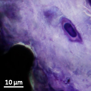Osteocyte/Osteoblast - bone bonding
