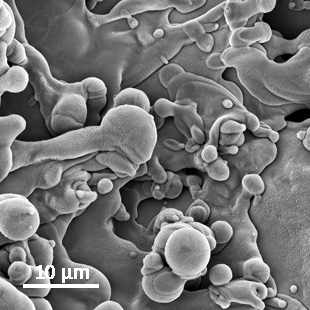 Micro implant - bone bonding