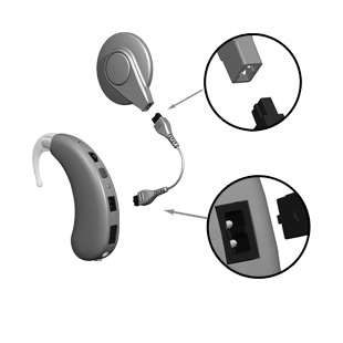 Changing cable on your cochlear implant