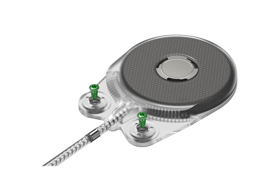 Neuro ZTI - designed for simple and safe surgery