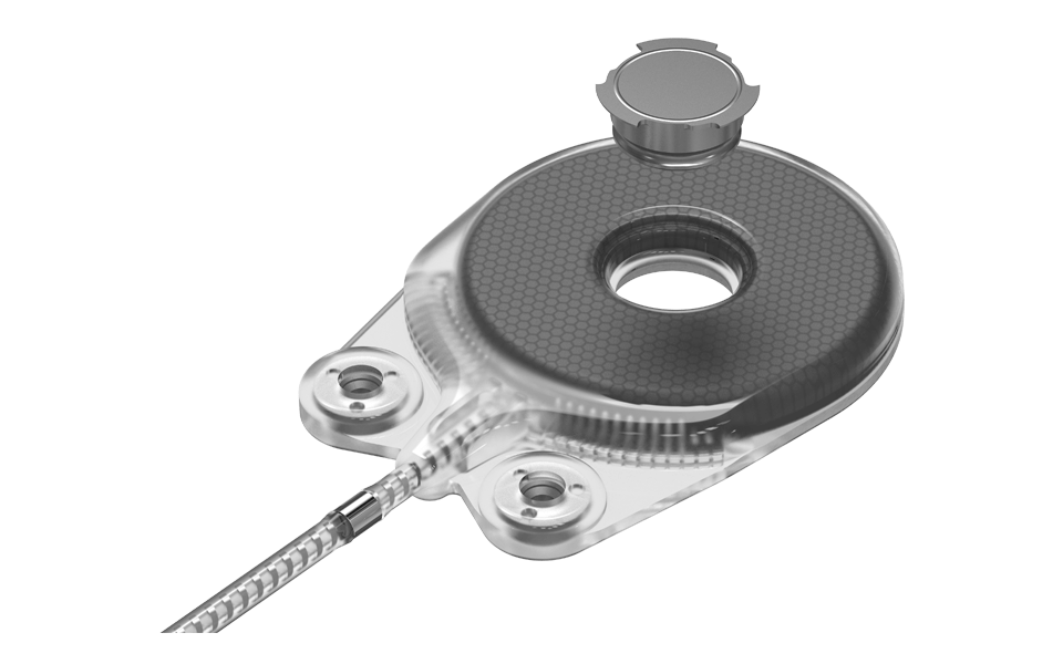 Neuro ZTI - safe for MRI scanning