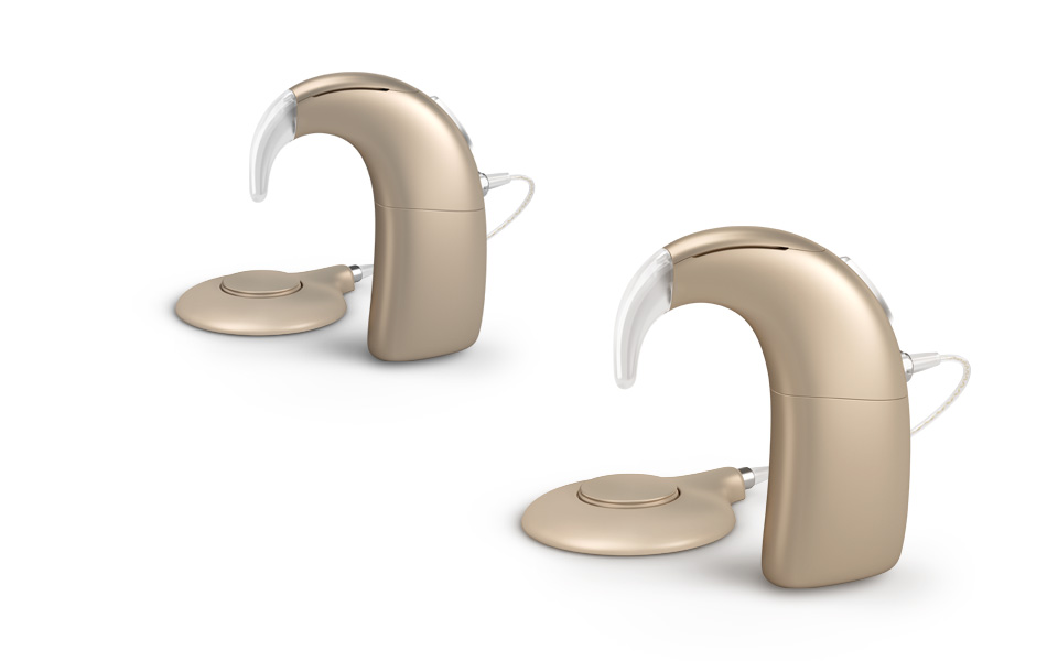 Cochlear implantation can be used if you suffer from hearing loss in one ear (single-sided) or both ears (bilateral). 